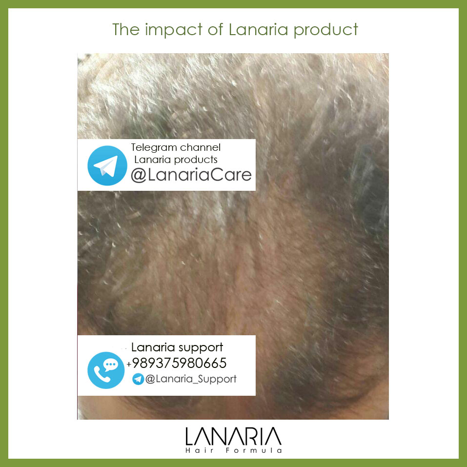 lanaria hair tonic