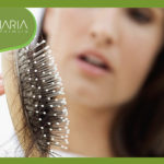 ریزش موی هورمونی-محلول لاناریا دکتر نوروزیان - lanaria